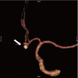 Click on image to zoom Figure 2