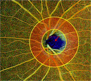 Click on image to zoom