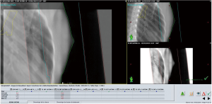 Click on image to zoom