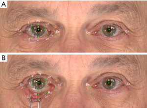 Click on image to zoom