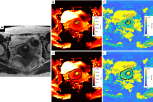 Click on image to zoom