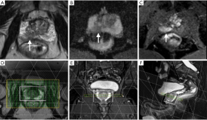 Click on image to zoom