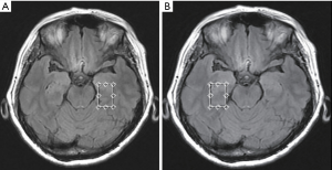 Click on image to zoom