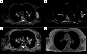 Click on image to zoom