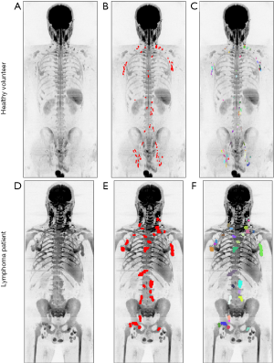 Click on image to zoom