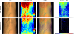 Click on image to zoom