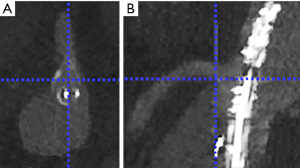 Click on image to zoom