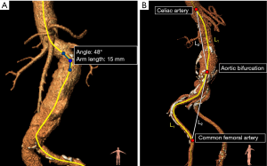 Click on image to zoom