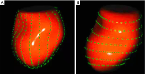 Click on image to zoom