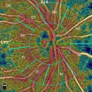 Click on image to zoom