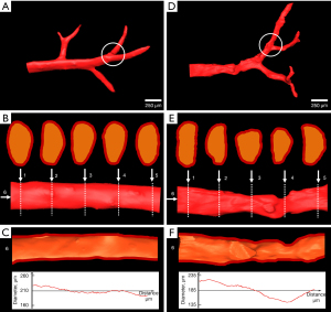 Click on image to zoom