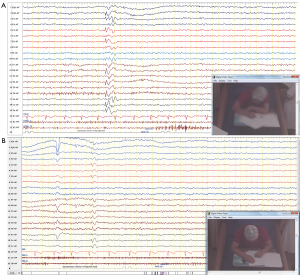 Click on image to zoom
