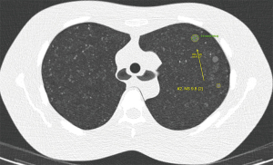 Click on image to zoom