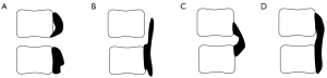 Click on image to zoom
