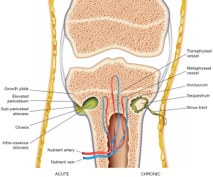 Click on image to zoom