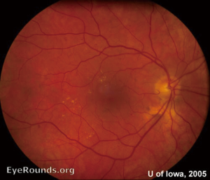 Click on image to zoom