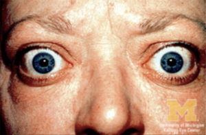 Click on image to zoom