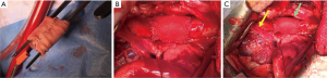Click on image to zoom