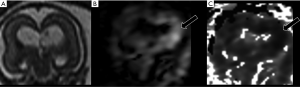 Click on image to zoom