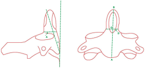 Click on image to zoom