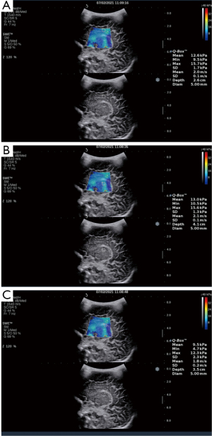 Click on image to zoom