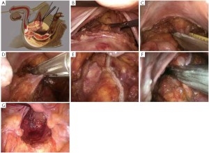 Figure 18