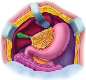Click on image to zoom Figure 12