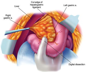 Click on image to zoom Figure 13