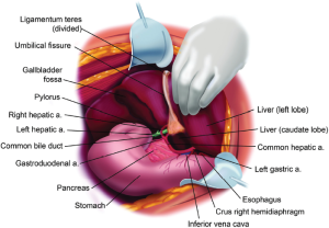 Figure 15