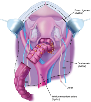 Figure 18