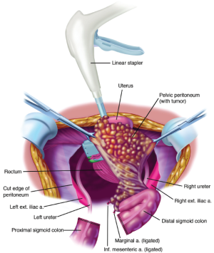 Figure 19