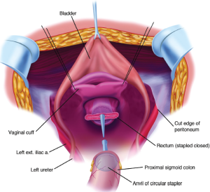 Figure 20