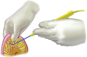 Click on image to zoom Figure 22