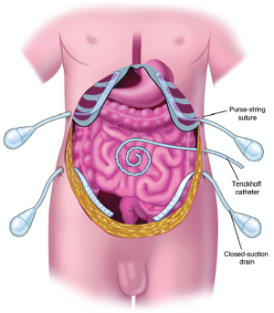 Figure 27