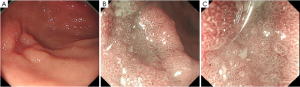 Click on image to zoom