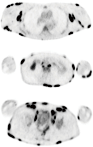 Click on image to zoom