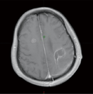 Click on image to zoom