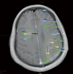 Click on image to zoom