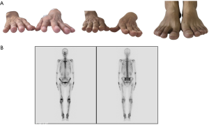 Click on image to zoom