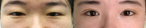 Click on image to zoom