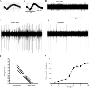 Click on image to zoom