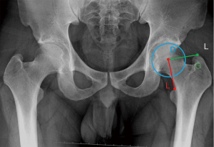Click on image to zoom