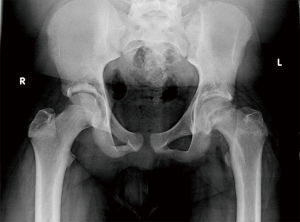 Click on image to zoom