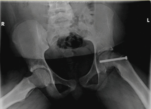 Click on image to zoom
