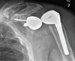 Click on image to zoom