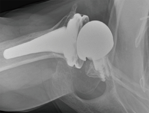 Click on image to zoom