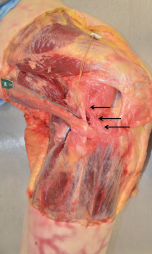 Click on image to zoom