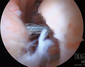 Click on image to zoom