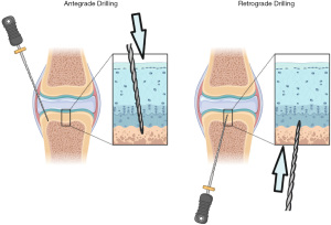 Click on image to zoom