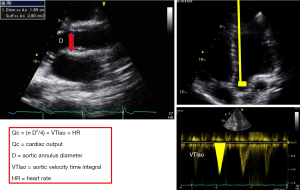 Click on image to zoom